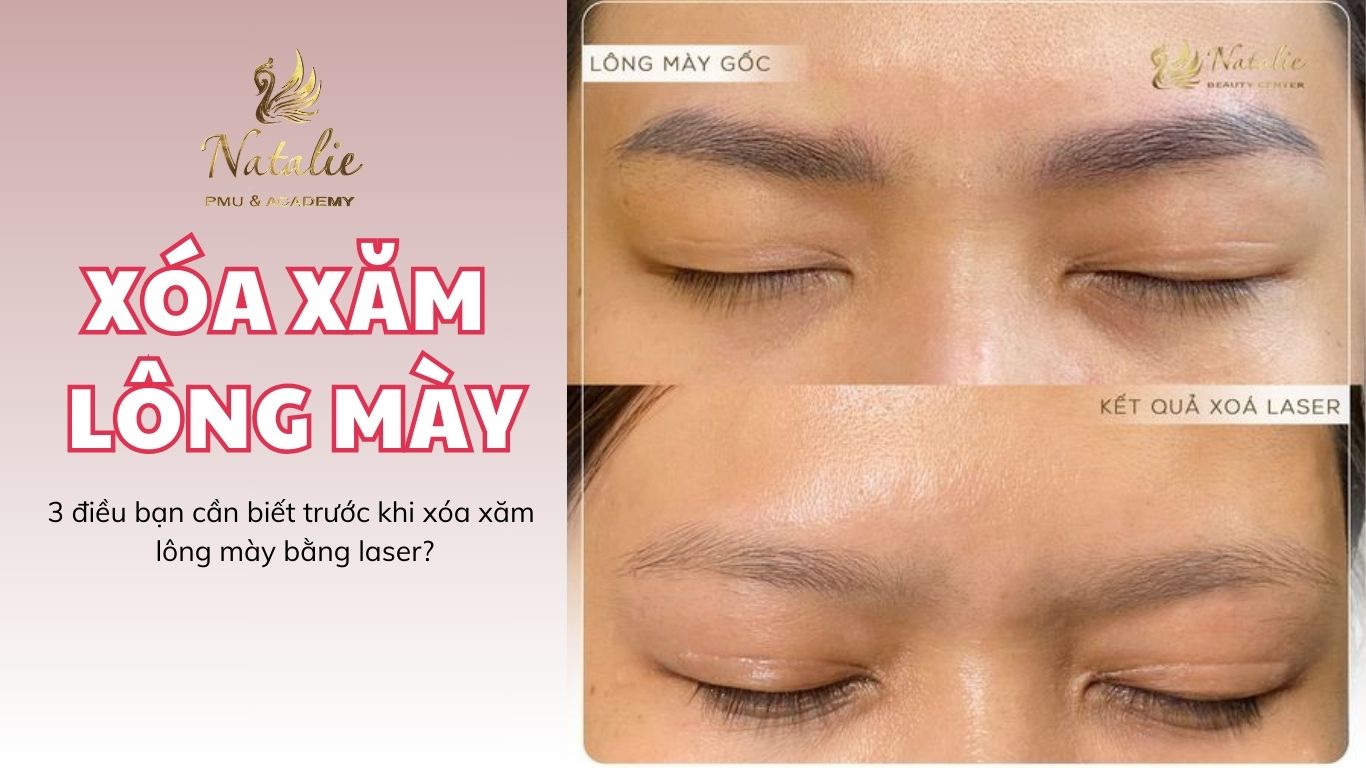 Xóa Xăm Lông Mày  Và 3 Điều Bạn Nên Biết